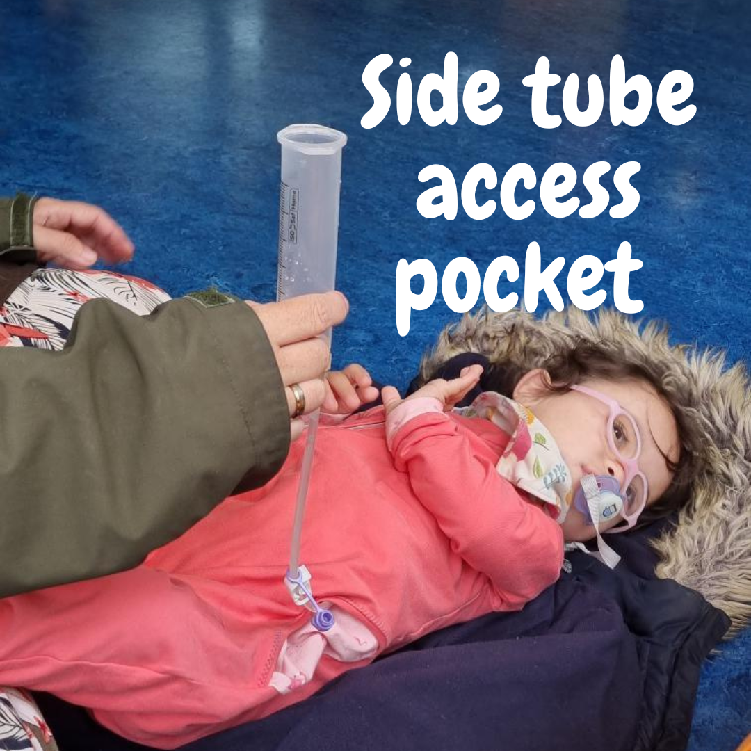 feeding tube access zip romper